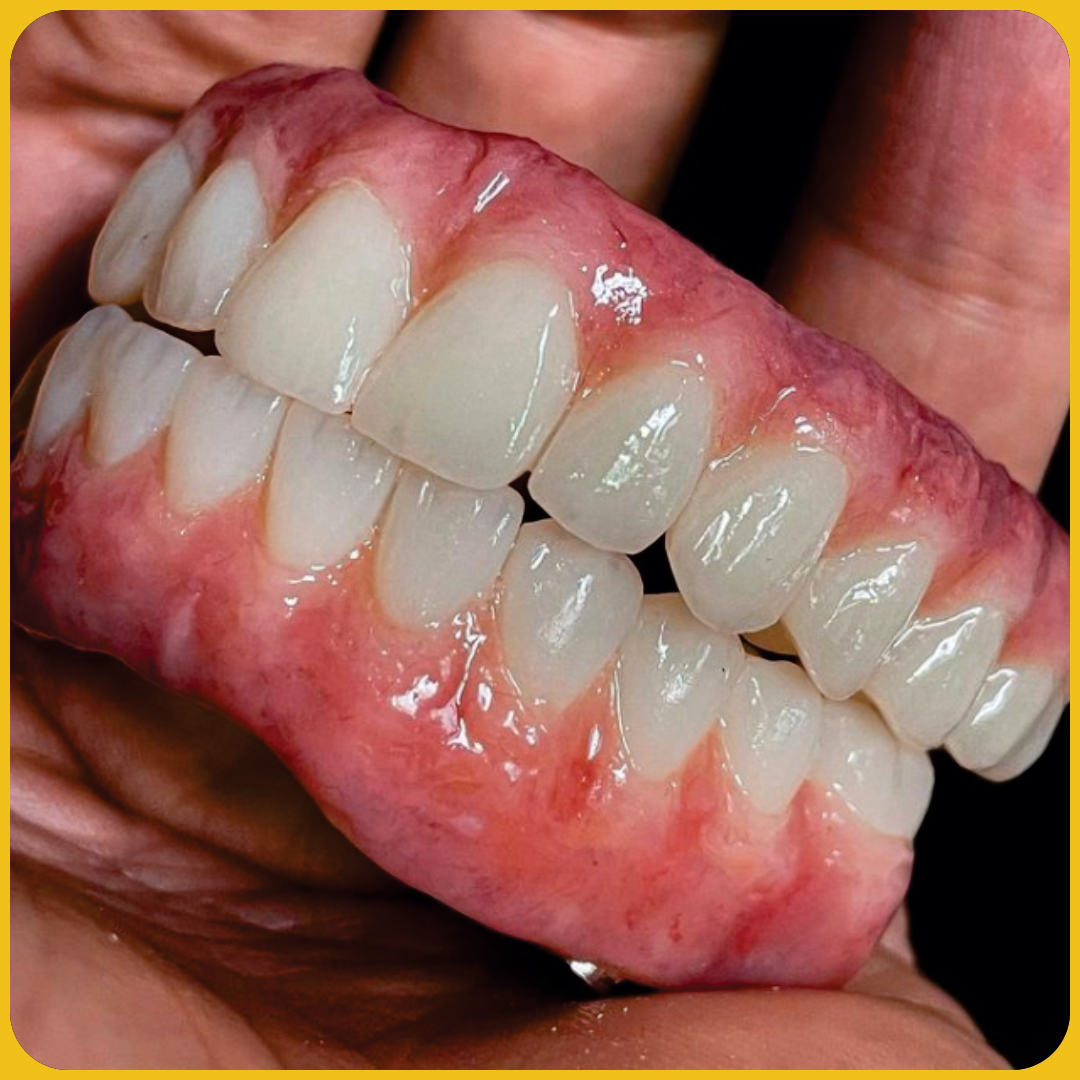 FULL-ZIRCONIA-1