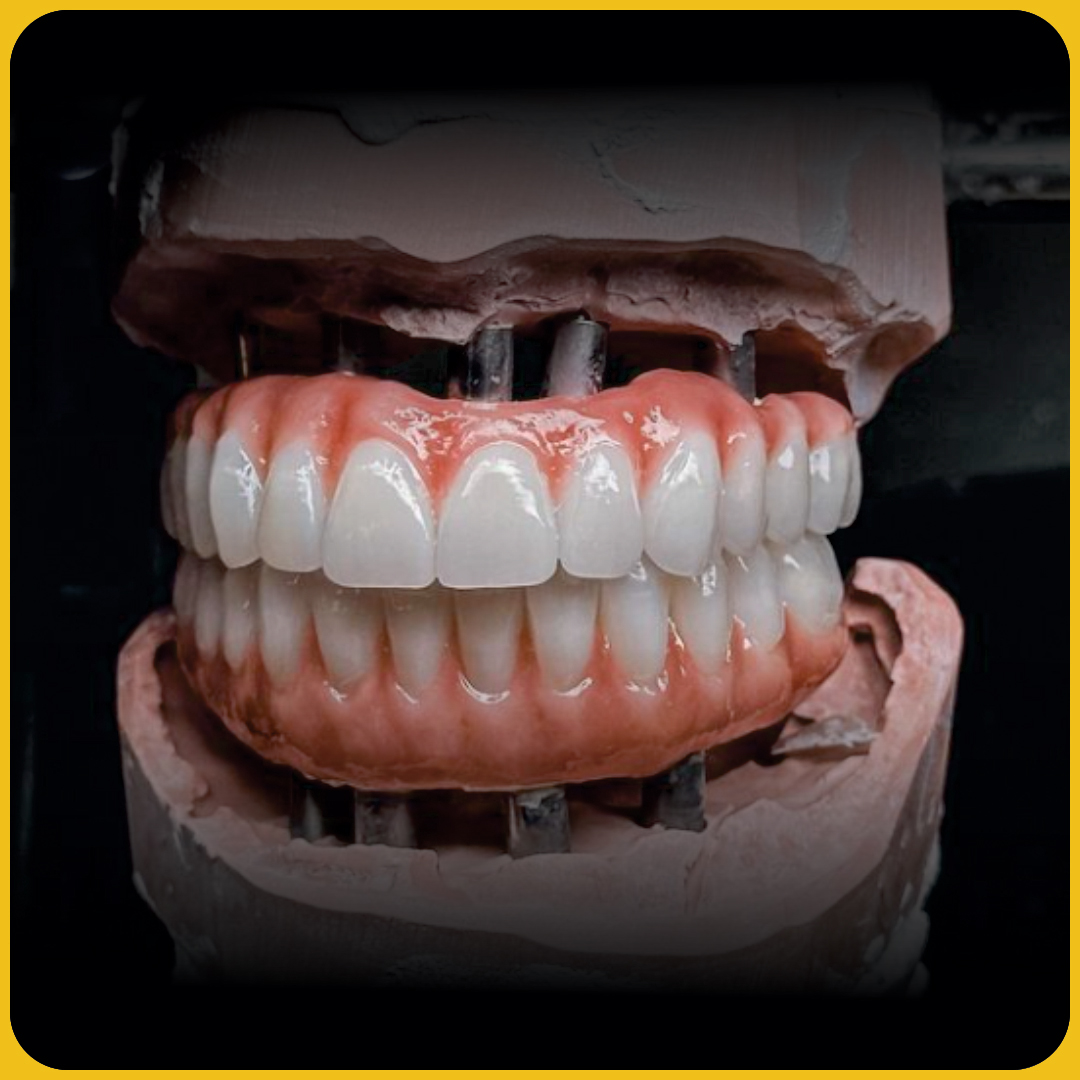 FULL-ZIRCONIA-3