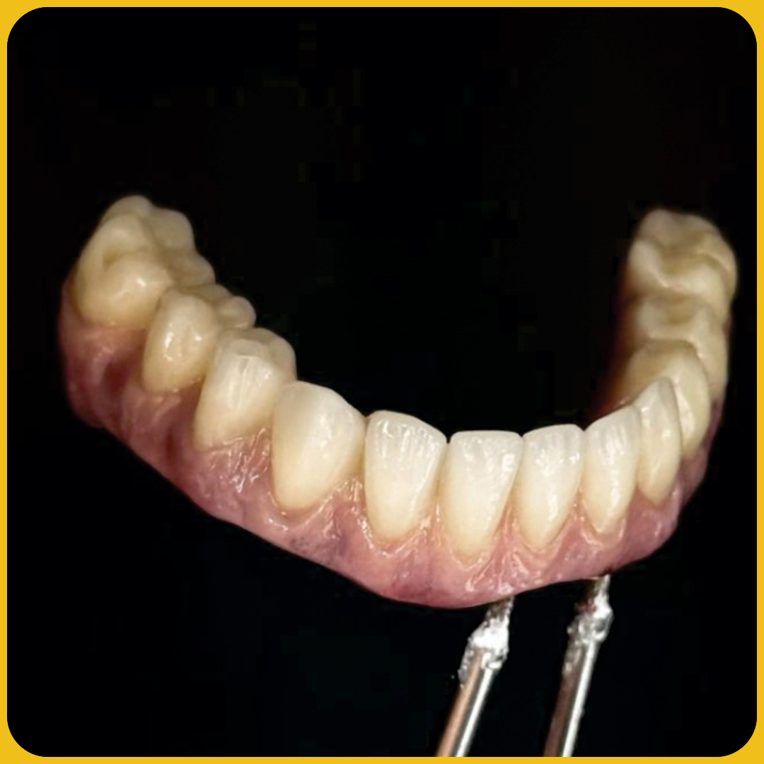 FULL-ZIRCONIA-4